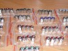 Seturi Capacele Ventil Din Inox Fara Antifurt - 20 Ron/Set